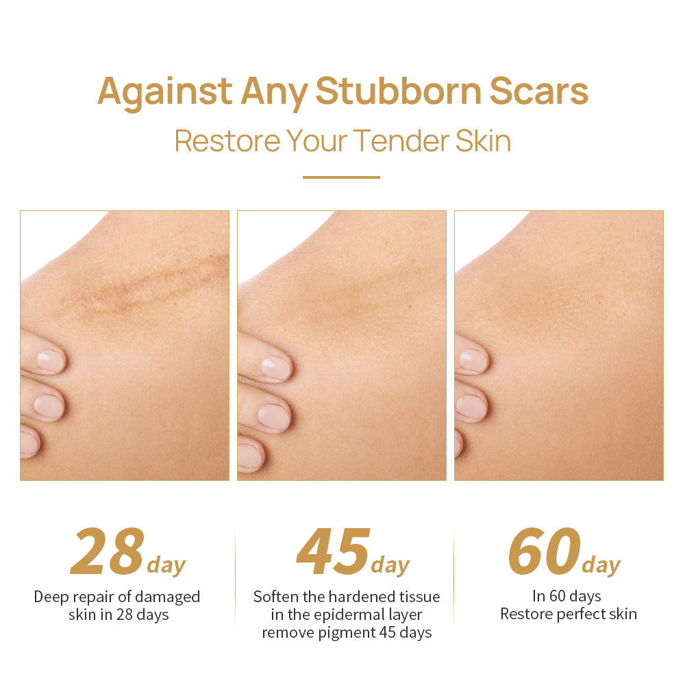 LANBENA SCAR AND ACNE MARK REMOVAL GEL 30g